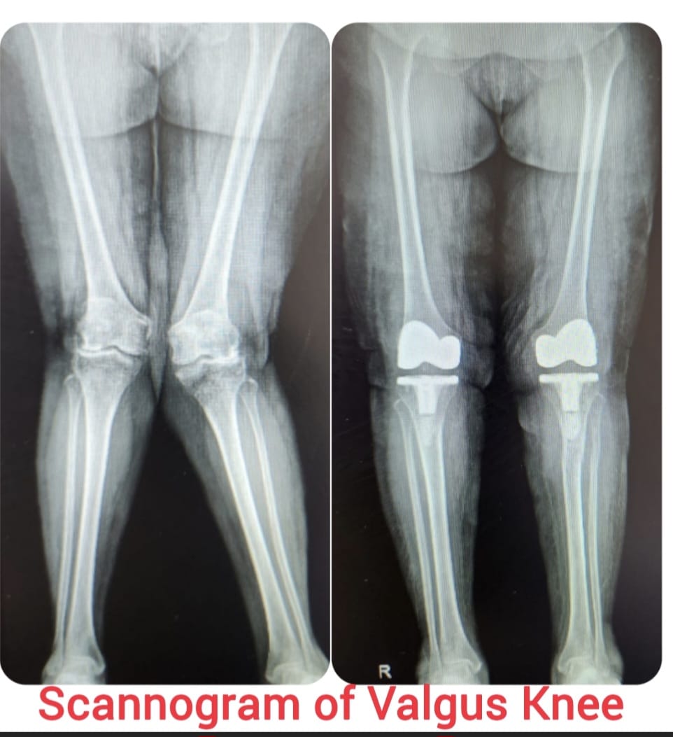 Knee X-ray 5